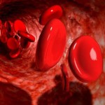 Что означает низкий гемоглобин