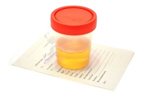 analysis of urine